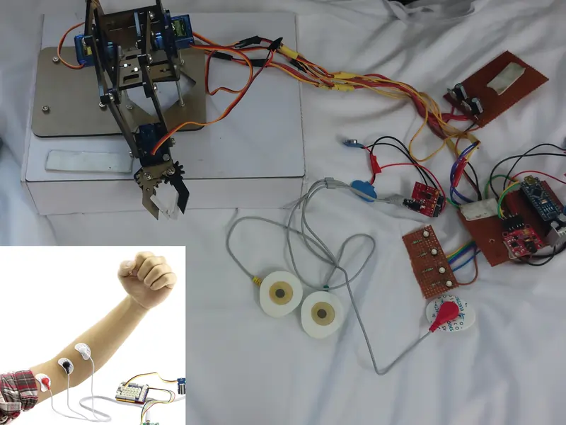 arduino based emg robotic arm project